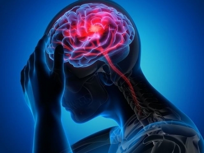 Neuroimagerie et neurostimulation