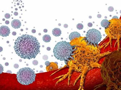 Corrélation entre cellules cancéreuses, inflammation et cellules immunitaires